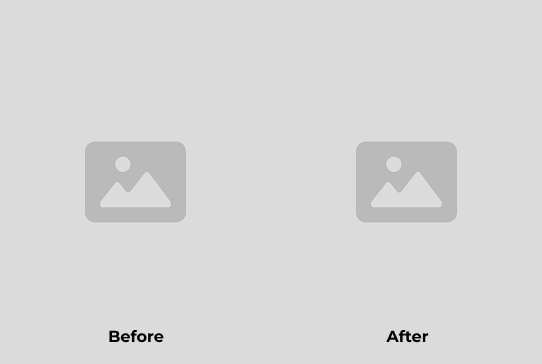 Before After
